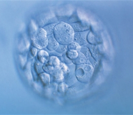 俄罗斯试管婴儿医院成功率排名